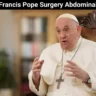 Francis Pope Surgery Abdominal